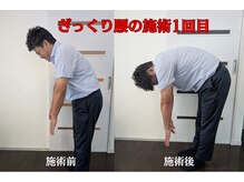 サウレ(Saule)/急な腰痛の施術前→施術後