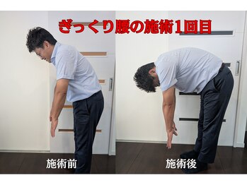 サウレ(Saule)/急な腰痛の施術前→施術後