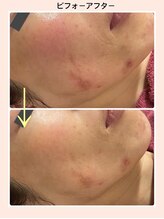 リファイン(REFINE)/もっとお肌を綺麗にしたい！