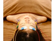 【リフトアップ】頬のもたつきをシャープに解消！垢抜け美人へ