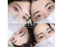 ベリール(Be'Leel)の雰囲気（症例写真は "Instagram" をCheck★［@medical_beleel］）