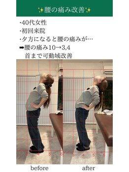 オルカ整体院(ORCA整体院)/【鹿児島/肩こり】