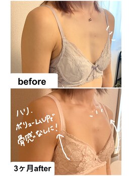 つばききよら/3カ月でハリ&ボリュームアップ！