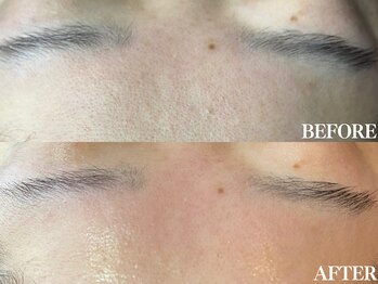 サロン ムスブ(salon MUSUBU)/山梨エステ/甲府エステ