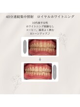 プラスビーセルフ(+b self)/ホワイトニングビフォーアフター