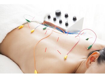 こらんこらん鍼灸院/鍼にパルスを通します