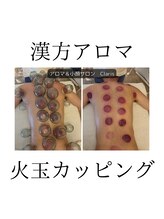 クラリス(Claris)/火玉カッピングで血液サラサラ♪