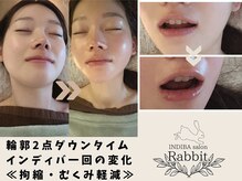 ラビット(rabbit)の雰囲気（様々な術前・術後ケアもお任せください。）