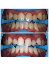 コナホワイトニング 神保町/セルフホワイトニング神保町