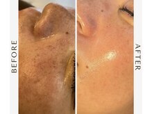 エスサロン(S.salon)/セラピール