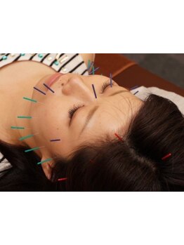 鍼灸施術を受けたい