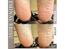 エミナル 恵比寿(EMINAL)の雰囲気（モチモチ足裏へ大変身できるペディプランニング♪）