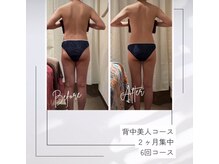 レムロード 川口店/ヒップアップ、太ももスッキリ