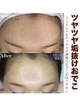 エリス(ELISSE)/フェイシャルワックスで垢抜ける