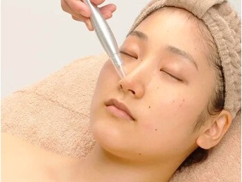 ミソル(misolle.)の写真/【毛穴洗浄】毛穴汚れをごっそりと除去！定期的なメンテナンスで目立たない毛穴に♪朝のメイクノリもUP◎