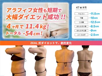 ジール(ZEAL)/痩身/ダイエットプランのお客様