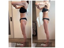 エヌア(nA)の雰囲気（最新痩身機器導入！2ヶ月でしっかり結果出しビフォーアフター♪）