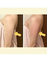 ラウレア(Laule'A)/最新痩身ボディ×レモンボトル