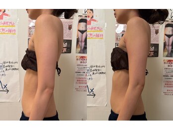 さとう美容整体 川崎本店/巻き肩矯正