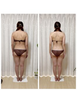 ニピ(NiPi)の写真/脂肪＋筋膜＋骨盤ケアで美しく健康的に痩せやすい体に◇確かな技術と安らぎの空間が自慢のエステサロン◎