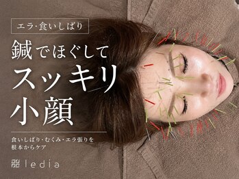ルディア 堂島店(ledia)/大阪美容鍼lediaルディア堂島店