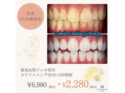 ホワイトニングショップ 高知店の写真