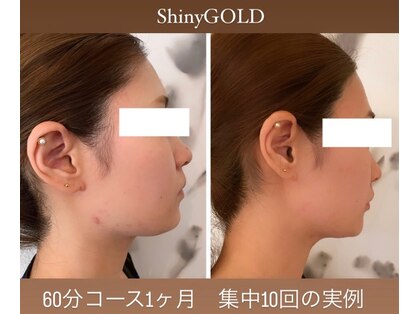 シャイニーゴールド 新所沢店(Shiny GOLD)の写真