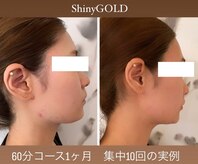 シャイニーゴールド 新所沢店(Shiny GOLD)