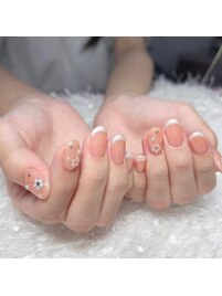 フレンチ☆フィルイン☆ケア