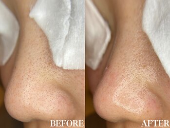 サロン ムスブ(salon MUSUBU)/山梨エステ/甲府エステ