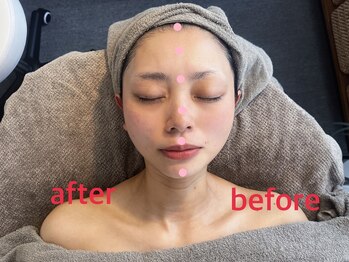 セレンディー(serendi)/小顔リンパ&ヘッドセラピー