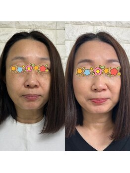 アマテラス(AMATERAS)/顔色を出すには似合う色を!