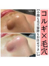 ヌナ(nuna)/顔も毛穴も引き締まる