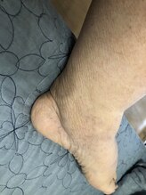 リデザイン 京都(REDESIGN)/REDESIGN京都中医施術法