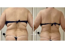 ピュウリリアーナ(Piu liliana)の雰囲気（50代後半のお客様☆【なりたいカラダを叶える☆】本格痩身!!）