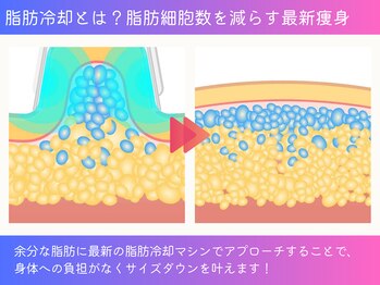 ボディーリセット 勝どき/≪脂肪冷却/勝ちどき≫