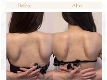 マシェリ(ma-che'rie)/3D肩甲骨剥がし+デコルテほぐし