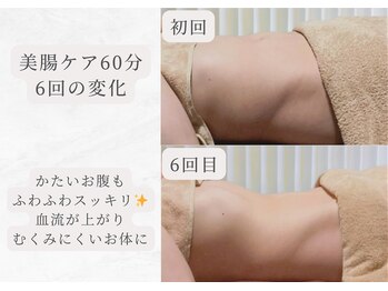 エイル(Eir.)/【腸もみ】before/after