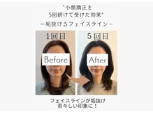 ムンプソナ(Mempesona)の雰囲気（回を重ねるごとに洗練されていくフェイスライン！）
