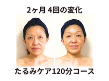 ビィミング(beaming)の雰囲気（身体から整えてキュッと引き締まった小顔に）