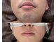 エイトブロウ 名古屋店(8BROW)の写真/名古屋でヒゲ脱毛ならBOSS｜青ヒゲ・毎日の髭剃りをラク