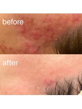 ブリエボ ニータ(BRILLER BONITA)/