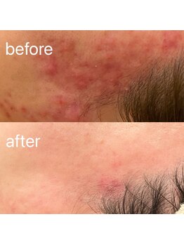 ブリエボ ニータ(BRILLER BONITA)/