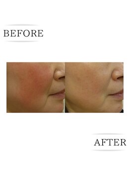 ココ(COCO)/お客様ビフォーアフター