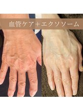 サンポ 神戸元町店(SANPO)/血管ケア×エクソソーム