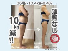 シルク ド ココ(Silk de Coco)/イヤーセラミック3ヶ月コース