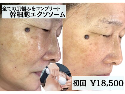 あすはれの写真