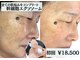あすはれの写真