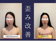 エレミュー 烏丸(Elemue.)/30代　《歪み改善》