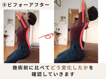 ハリデイズ/施術前後での変化です